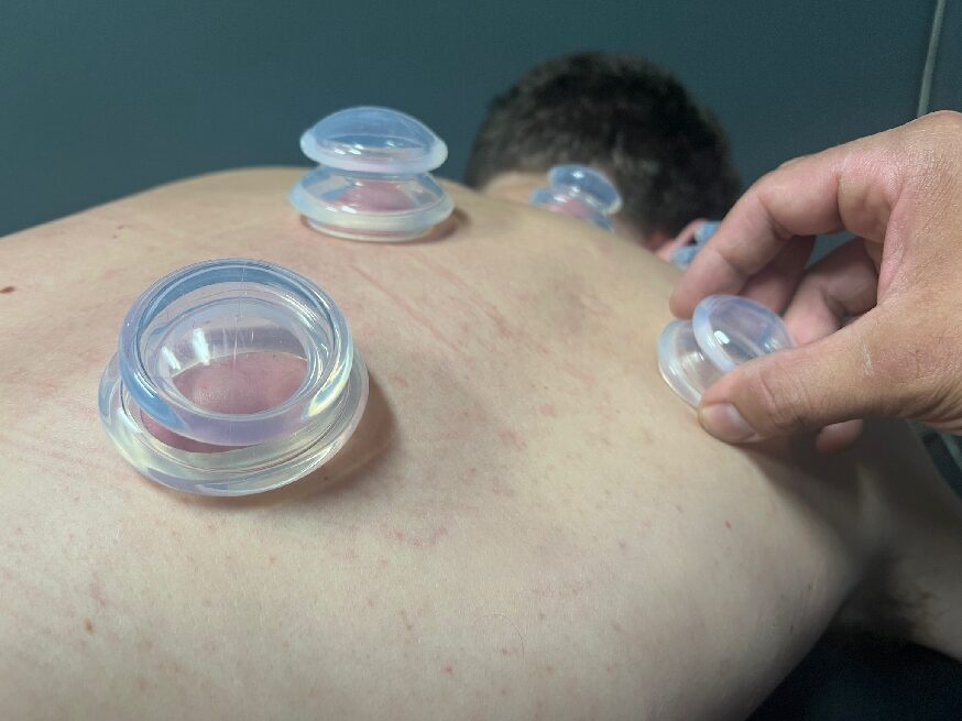 Cupping Services